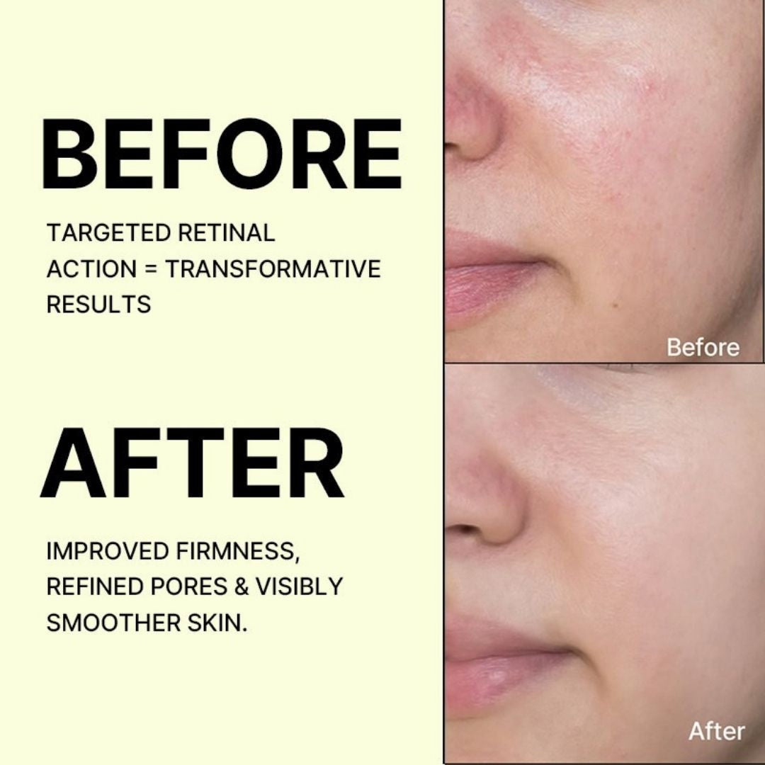 The Vita-A Retinal Shot Tightening Booster