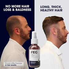 FEG PLUS- Hair Growth Spray 50ml - For Men and Women